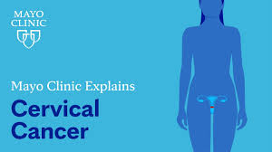 cervical cancer symptoms and causes