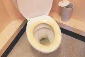 Toilet Seat Turned Yellow After