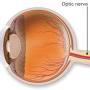 Optic nerve from www.aao.org