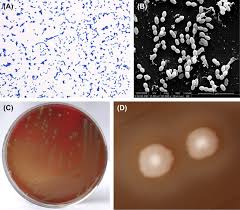 streptococcus an overview