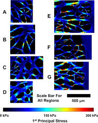 neural tissues of the lamina cribrosa