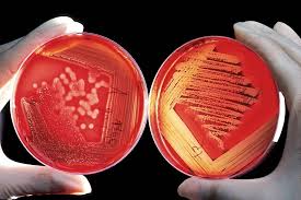 While some of the infections can be easily treated, some of. A Desfostatina Pode Tratar Com Eficacia A Bacteria Salmonella