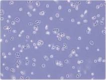 Image result for what type of cells are keratinocytes