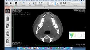 Dicom stands for 'digital imaging and communications in medicine'. Horos Dicom Viewer For Mac Free Download Renewmagazine
