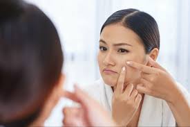 tackling acne scars what not to do in