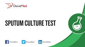 Sputum Culture Test