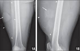 radiologic case study orthopedics