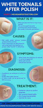 white spots on toenails causes home