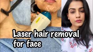 laser hair removal face my experience