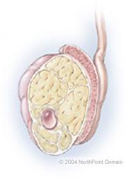 testicular cancer therapies