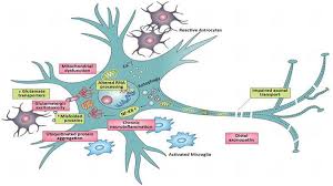 stem cell therapy in motor neuron