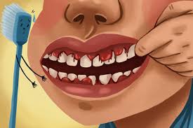 how to heal swollen gums helotes