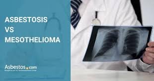 A cancer diagnosis may be overwhelming. Mesothelioma Vs Asbestosis Differences Symptoms And Treatments