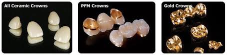 Porcelain Crown Pfm Crown Full Gold Crown Dental