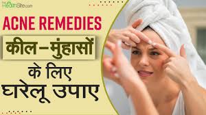 acne remes natural remes for