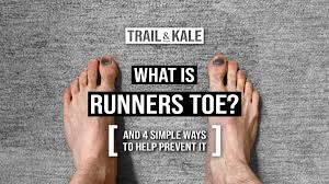 what is runners toe how to prevent