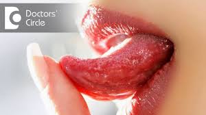 common causes of ulcers on tongue in
