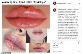 Bizarre New Beauty Trend Sees Women Use Lip Fillers And
