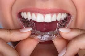 Brush up on how to care for your teeth with these tips from dentists. How Long Do I Have To Wear A Retainer After I Have Braces