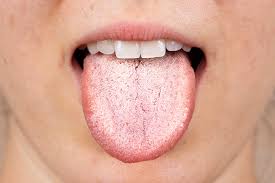 11 reasons for a white tongue treatments