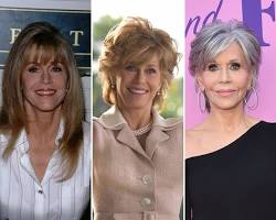 Imagen de Jane Fonda before and after plastic surgery
