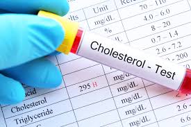 counting cholesterol how often should
