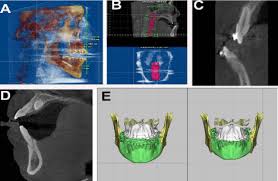 cone beam computed tomography in dentistry