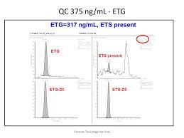 Forensic Toxicology Use Only Analysis Of Etg Ets Using The