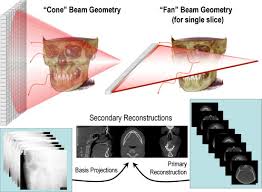 what is cone beam ct and how does it