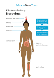 These are features of viral fever. Norovirus Symptoms Treatment And Prevention