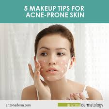 5 makeup tips for acne e skin