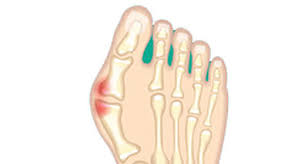 inside foot pain symptoms causes