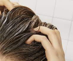 6 pro tips to deal with dry scalp