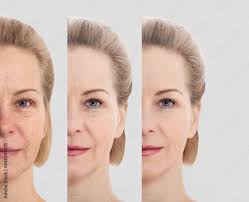 cosmetic skin care for wrinkled face