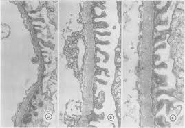 electron micrograph showing comparative