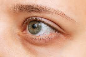 how crohn s disease affects the eyes