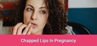 chapped lips in pregnancy best ways