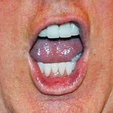 Image result for photo trump's mouth