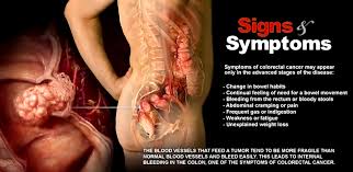 what are signs of rectal cancer storymd
