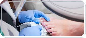 nail injury treatment near me in