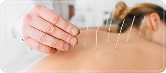 acupuncture cost in jersey city