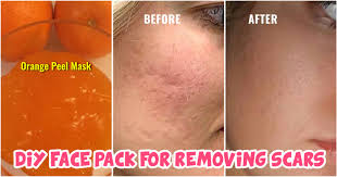 diy face pack for removing scars