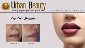 lip surgery thailand urban beauty