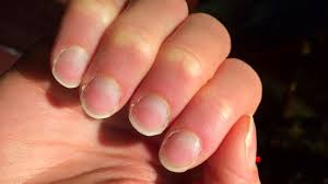 terry s nails pictures causes