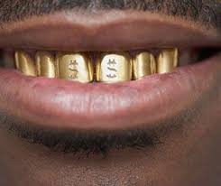 What to Know About Getting Gold Teeth