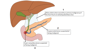 In teleost fish, and a few other species (such as rabbits), there is no discrete pancreas at all, with pancreatic tissue being distributed diffusely across the mesentery and even within other nearby organs, such as the liver or spleen. Schematic Of The Liver And Pancreas Showing The Inclusion Criteria For Download Scientific Diagram