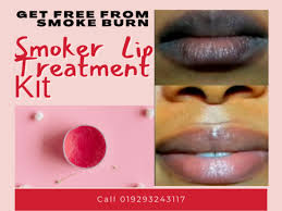 lifetod smoker lip treatment kit