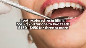 The total cost of your child's treatment will depend on the severity of the cavity (or cavities), how many teeth need fillings, and which type of filling material you choose. How Much Will A Cavity Filling Cost For Your Child Without Insurance Youtube