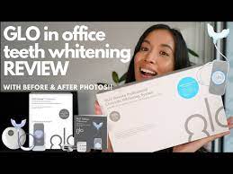 glo in office teeth whitening review