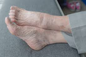 tips for foot care in the elderly